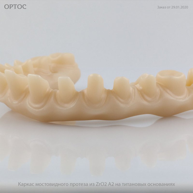 Фотографии каркаса мостовидного протеза из ZrO2 А2 11 - Фрезерный CAD/CAM центр Ортос Новости