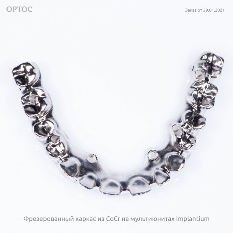 Фрезерованный каркас из CoCr на мультиюнитах Implantium 6 - Фрезерный CAD/CAM центр Ортос Новости