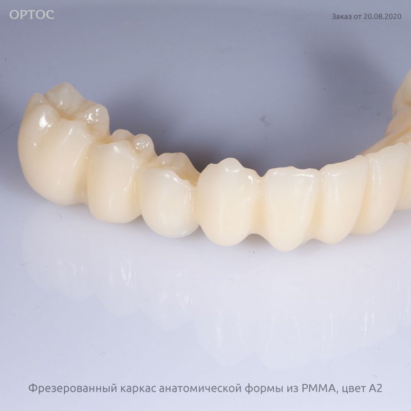Фотографии каркаса протеза анатомической формы из PMMA A2 4 - Фрезерный CAD/CAM центр Ортос Новости