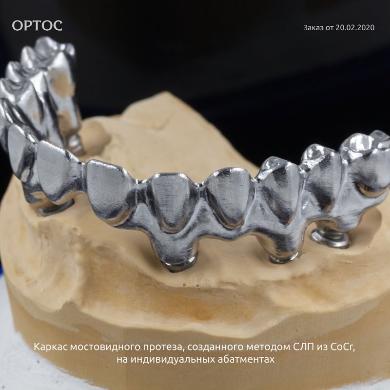 Фотографии каркаса мостовидного протеза, созданного методом СЛП из CoCr 10 - Фрезерный CAD/CAM центр Ортос Новости