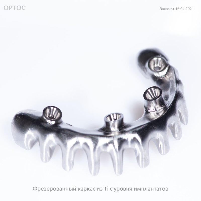 Фотографии фрезерованного каркаса из Ti с уровня имплантатов 2 - Фрезерный CAD/CAM центр Ортос Новости