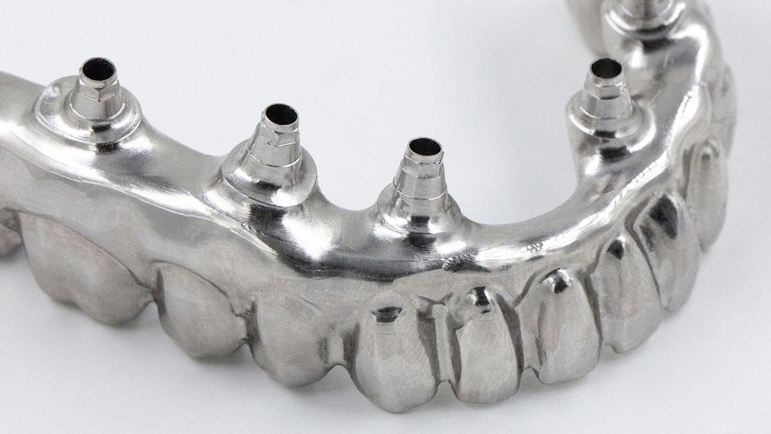 Преимущества цифровой стоматологии для зубных техников 2 - Фрезерный CAD/CAM центр Ортос Полезные статьи