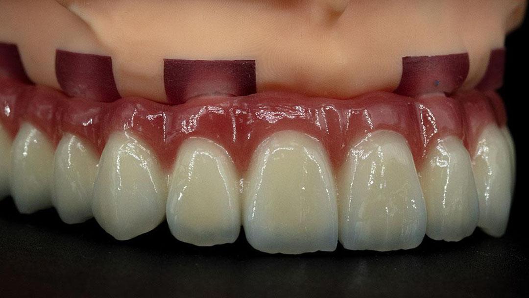 Преимущества цифровой стоматологии для зубных техников 3 - Фрезерный CAD/CAM центр Ортос Полезные статьи