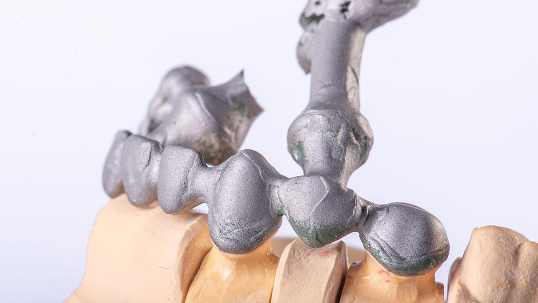 Преимущества цифровой стоматологии для зубных техников 1 - Фрезерный CAD/CAM центр Ортос Полезные статьи
